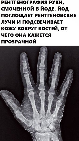 BEST | , ,  - 3  2020  19:07