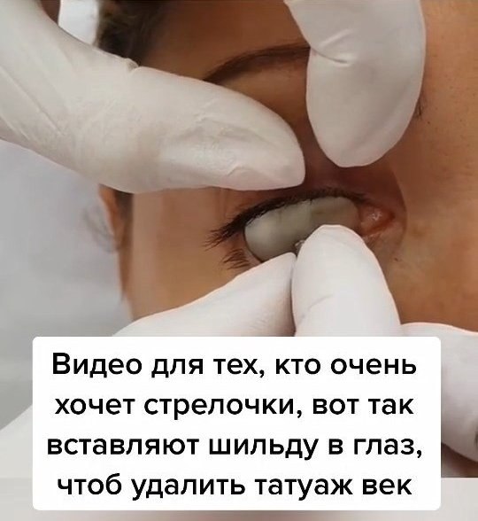 Как это страшно выглядит Я бы не рискнула пойти на такую процедуру! А Вы бы сделали себе татуаж ... - 3