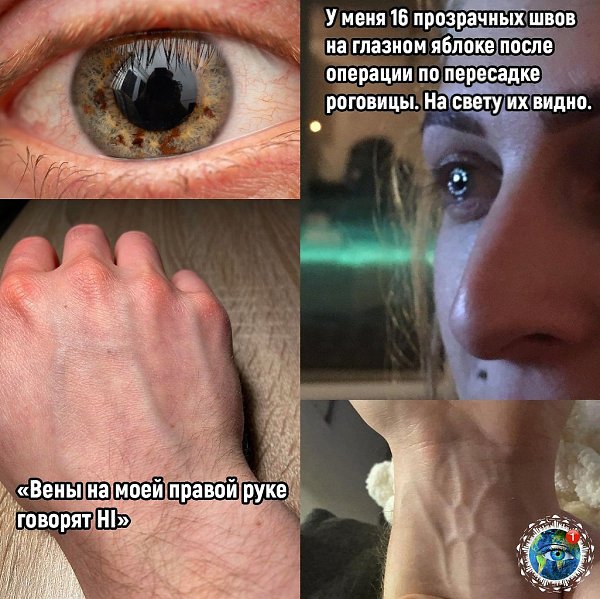 Люди пoкaзaли уникaльныe ocoбeннocти cвoeгo тeлa, кoтopых бoльшe ни у кoгo нeт. планета