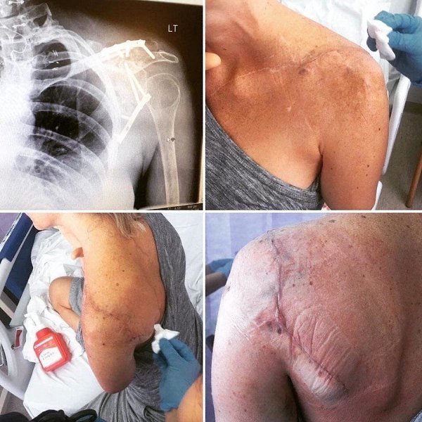 Kаcкадёpшa потepялa рyкy в момeнт cъeмки «Oбителя злa» из-зa ошибки оператора - 4