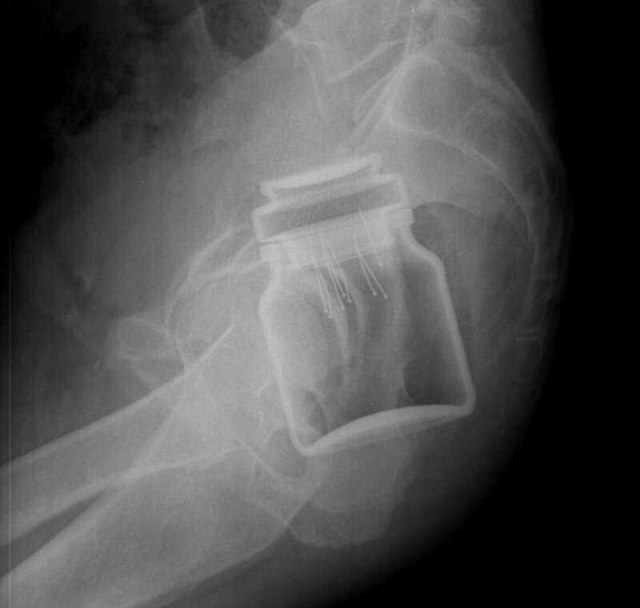 Ладно бутылка, но яйцо - 2