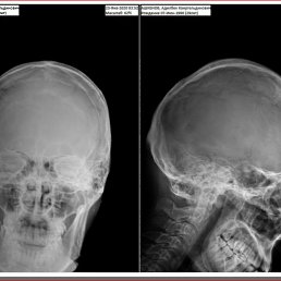 ��������, ��������, 60 ���