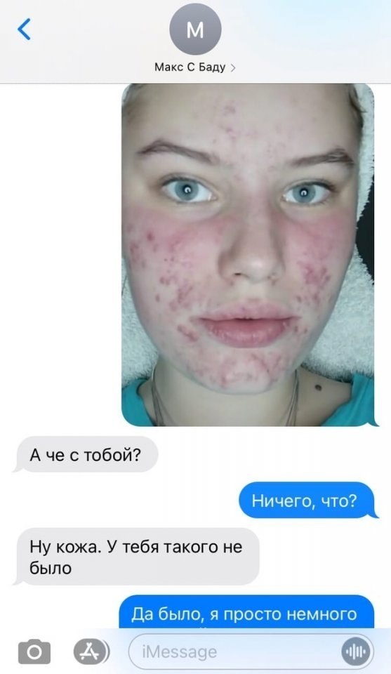        - 2