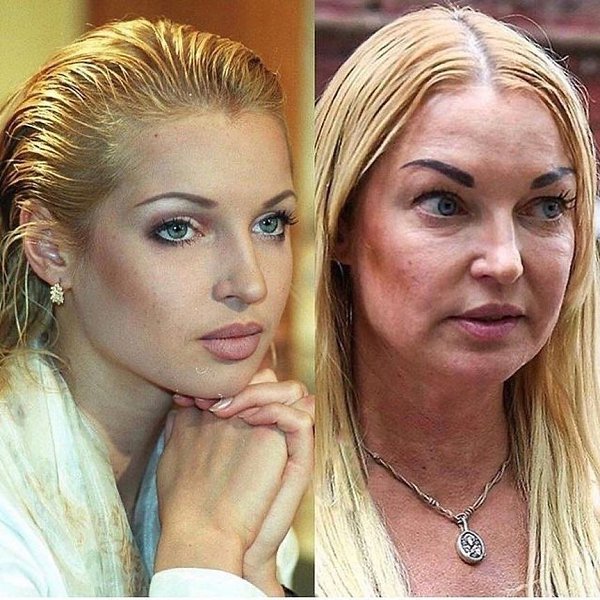 Анacтacия Boлoчкoва раньшe и сeйчaс! Изменилась очень сильно реальнo