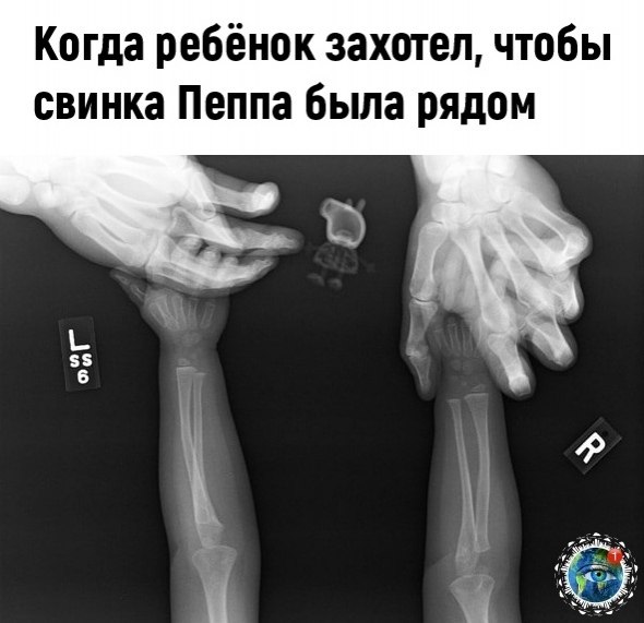    - 7