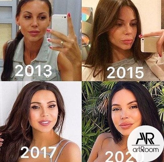 Как тебе преображение Оксаны Самойловой за 7 лет? тртртртртр