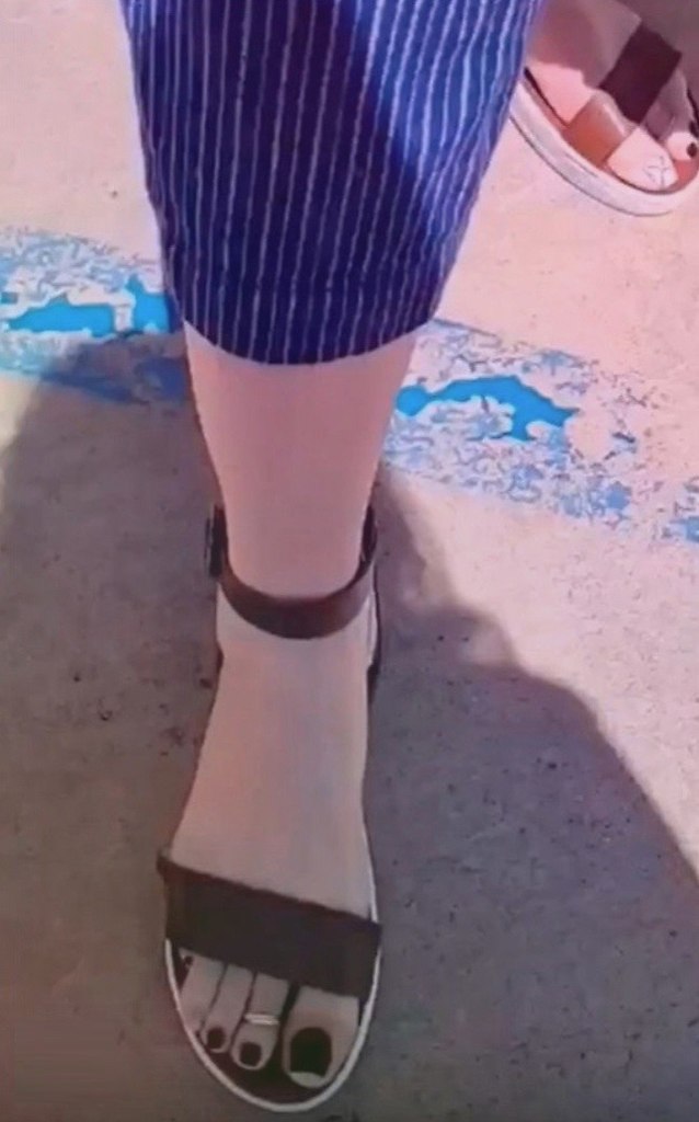   - 