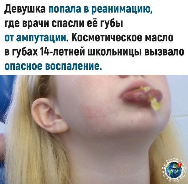 a�e�c�, �e�ep� o�a ���o��a ��e �e �a�o�e� �� ��e������. - 2