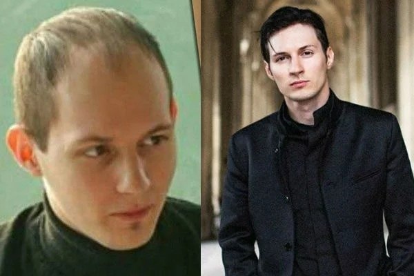 Дуров до операции и после пластической хирургии Как деньги меняют человека