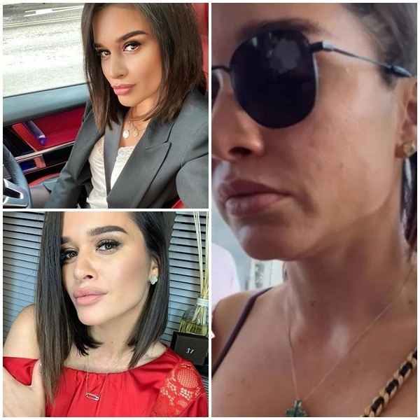 Кривой рот и обвисшее лицо: честное фото Бородиной попало в Сеть.В личном микроблоге Бородина ...