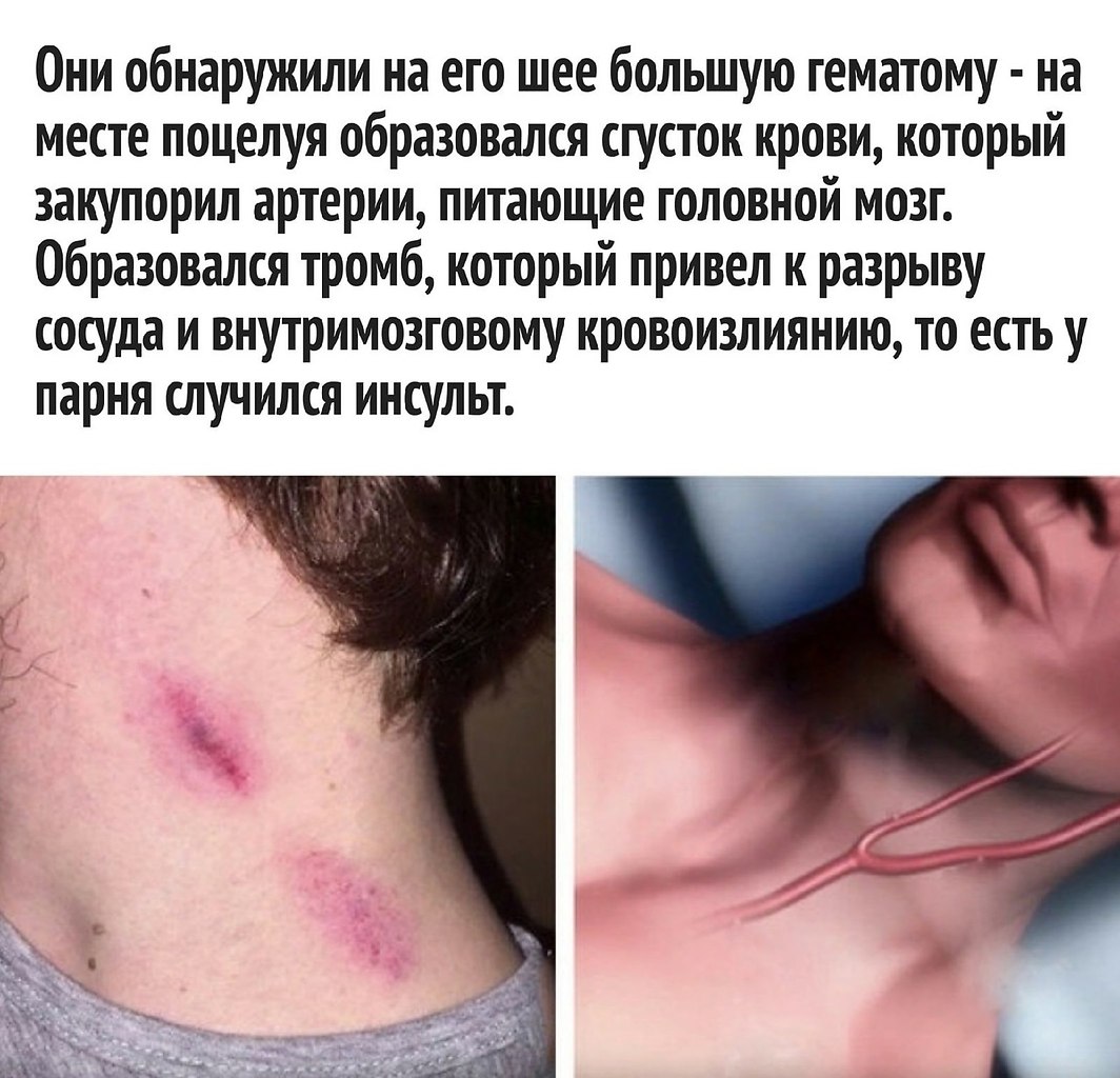    - 3