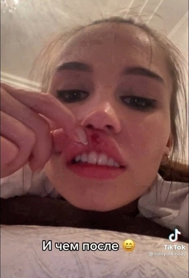     - 2