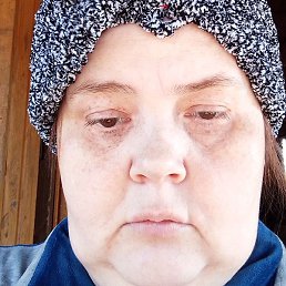 ����, ������, 44 ����