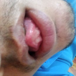 Amjad Opridy, �����-������, 24 ����