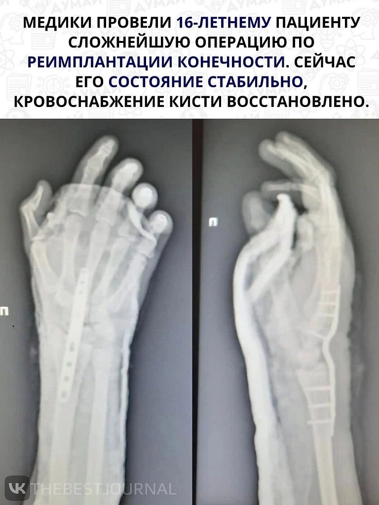      .   ! - 2