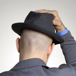 Igor, �����, 44 ����