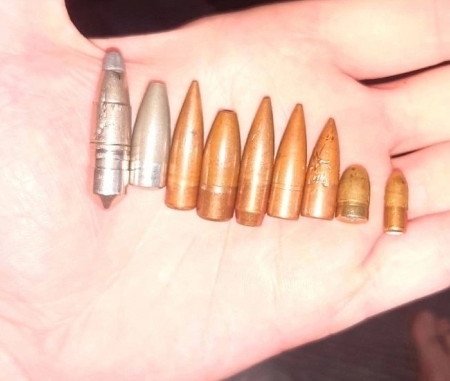 В Сомали женщина получила огнестрельное ранение клитора. Пуля была успешно извлечена с применением ... - 3