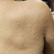 ������ ����������, 47 ���, ����