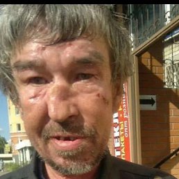 ˸��, ����, 57 ���