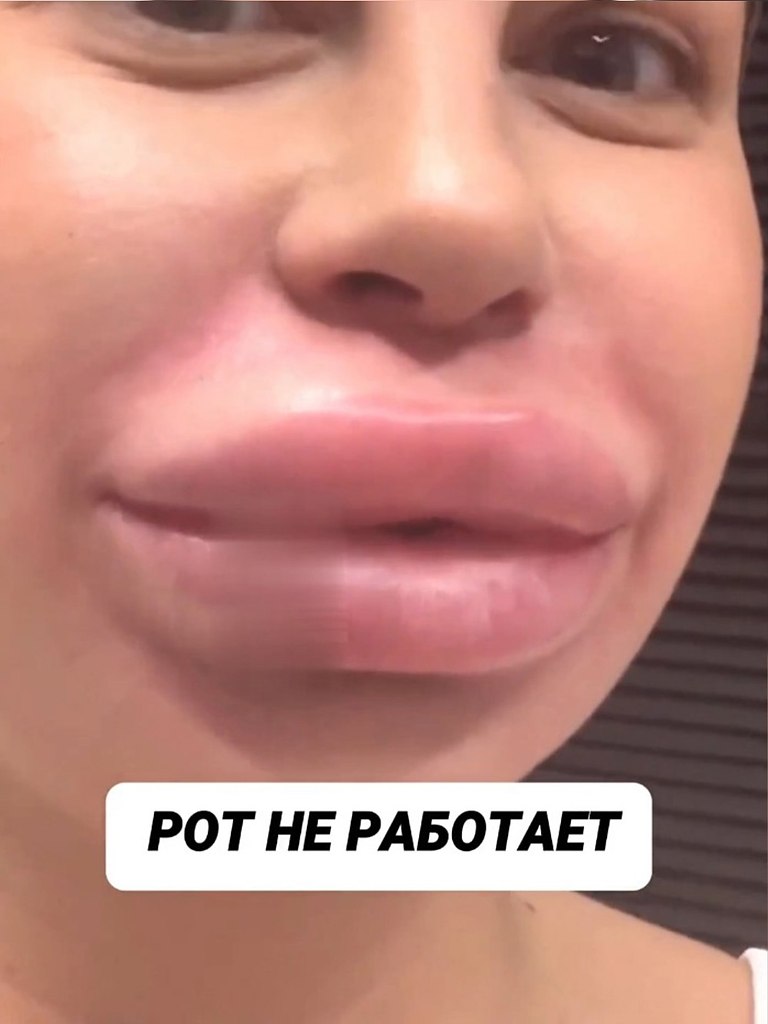,         - 2