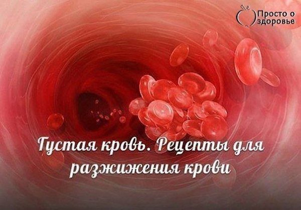 ЧЕМ ОПАСНА ГУСТАЯ КРОВЬ И ЧТО НАДО ДЕЛАТЬ? Некоторые знают, что густую кровь надо разжижать. ...