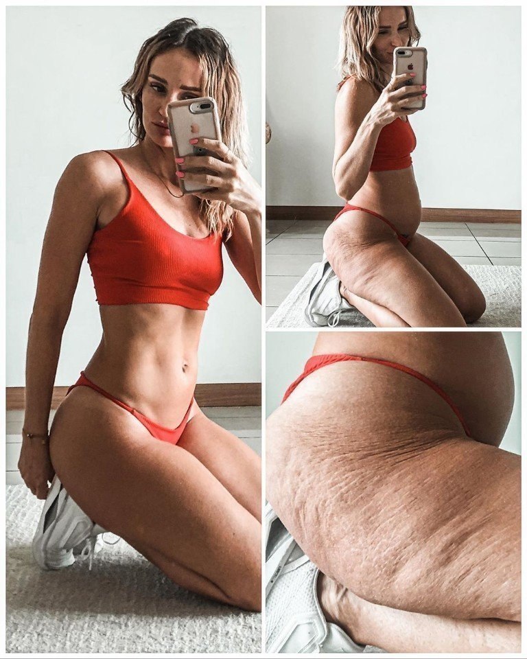 Не ведитесь на все эти идеальные фотографии в инстаграме, все мы имеем растяжки и целлюлит - и это ... - 4