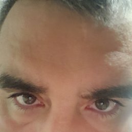 , 39, 