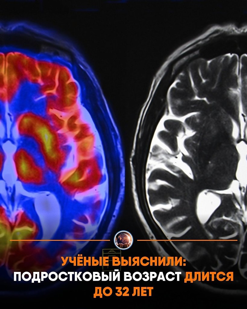 �cc�e�o�a�e�� �poa�a����po�a�� �o�ee 4 ��c�� ��-c����o� � �p���� � ���o��, ��o �e�o�e�ec��� �o�� ...