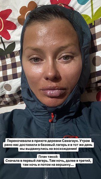 Вика Боня приехала в Москву, чтобы сделать коррекцию губ и лица. Скоро пройдет реабилитация, и она ... - 4