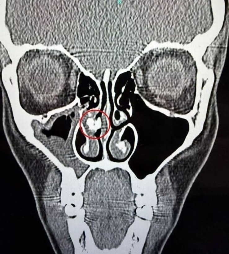 ������� 35 ��� ������ ���� � ���������� ������������ � ���� � ���� �� �����������, � ��� ����. ...