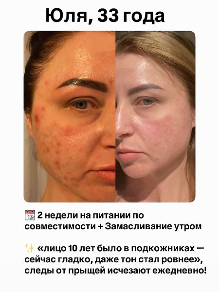 У тeбя не проблемная кожа. У тебя перегруженная печень. Даже если ты: — умываешься 2 раза в день — ... - 6