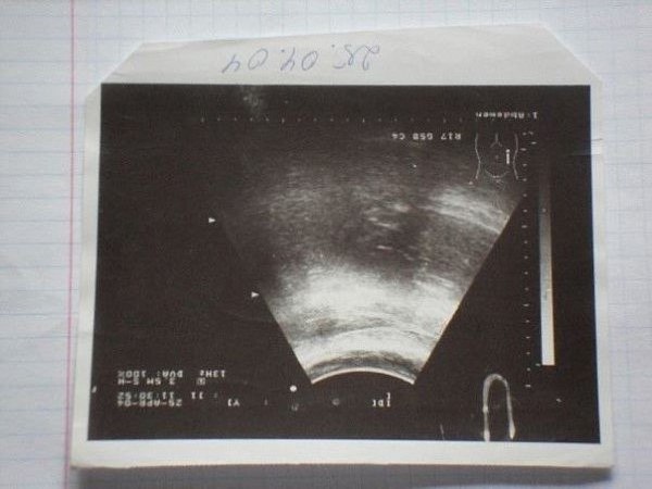     ?     68   22        ...