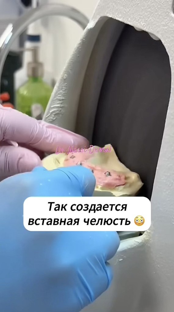   . - 2