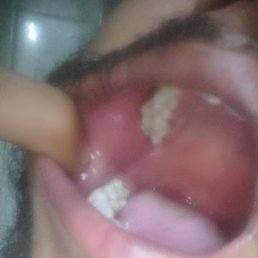 Vinod Mishra, �������, 25 ���