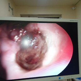 Kolya, �����, 57 ���