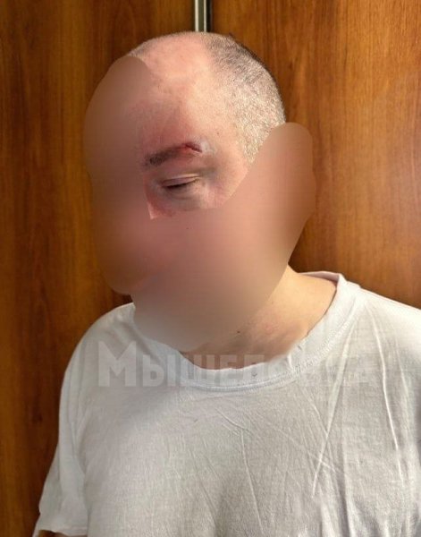 Красноярец не так понял жену и получил по голове. Супруги решили разнообразить вечер, и жена ... - 2