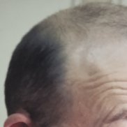 ����, 56 ���, ������