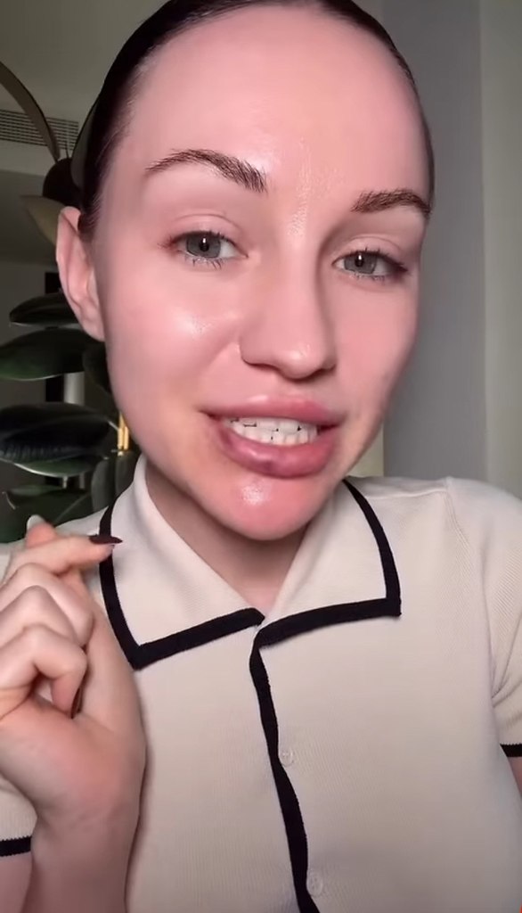        - 2