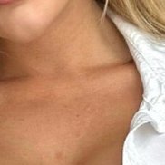 , 25 , 