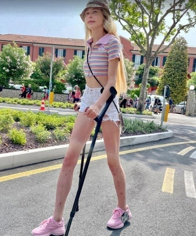 Американская модель Тереза Фишер приняла смелое решение и изменила свою внешность, увеличив свой ... - 2