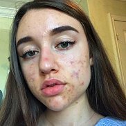 ����, 18 ���, ������