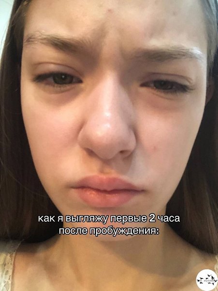 pee oe.     - 2