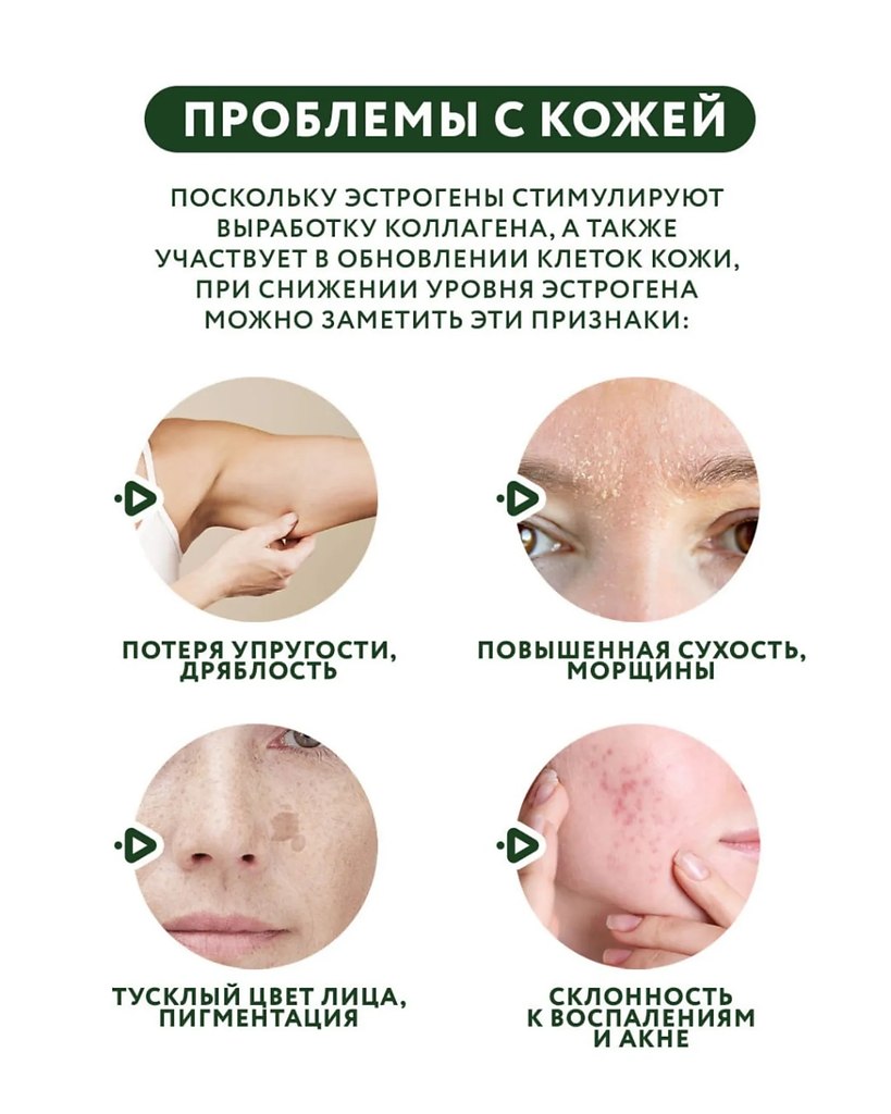 Этот пост поможет вам выявить нехватку эстрогенов.Листайте карточки - 5