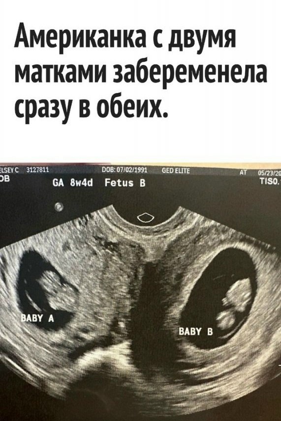 ���� ����� ������!
