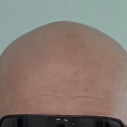 ������, 44 ����, ���������