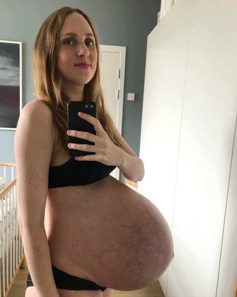    - 2