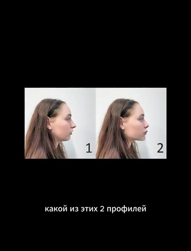   - 2