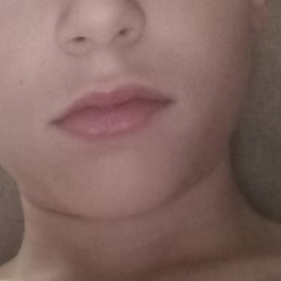 , , 18 