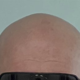 ������, ���������, 44 ����