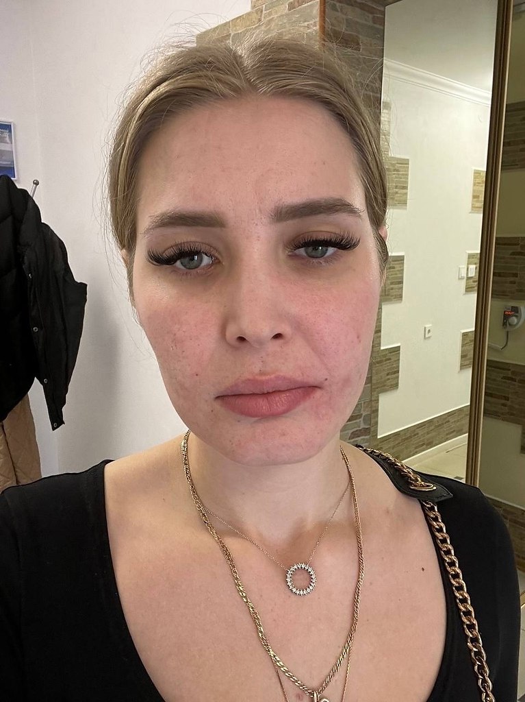               17  ... - 10